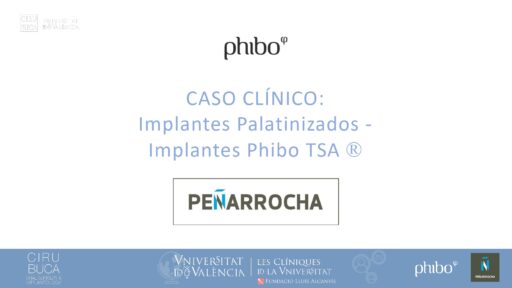 5.Implantes Palatinizados. Implantes Phibo TSA 1_page-0001