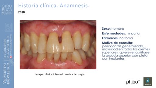 Manuel_Alamar_cirugia_periapical