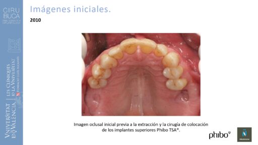 Manuel_Alamar_cirugia_periapical