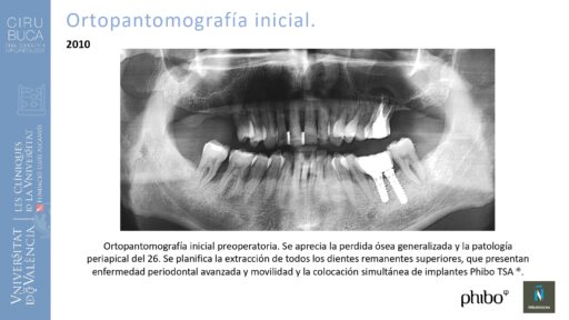 Manuel_Alamar_cirugia_periapical