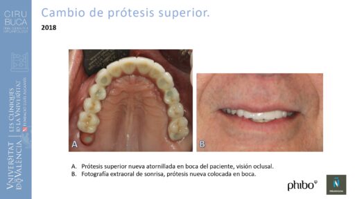 Manuel_Alamar_cirugia_periapical