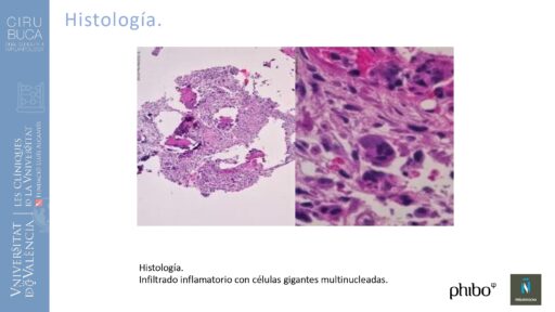 Rosa García Puchades_Cirugia_periapical_periimplantaria