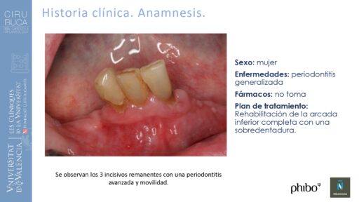 Victoria Bruscas_cirugia_periapical_periimplantaria
