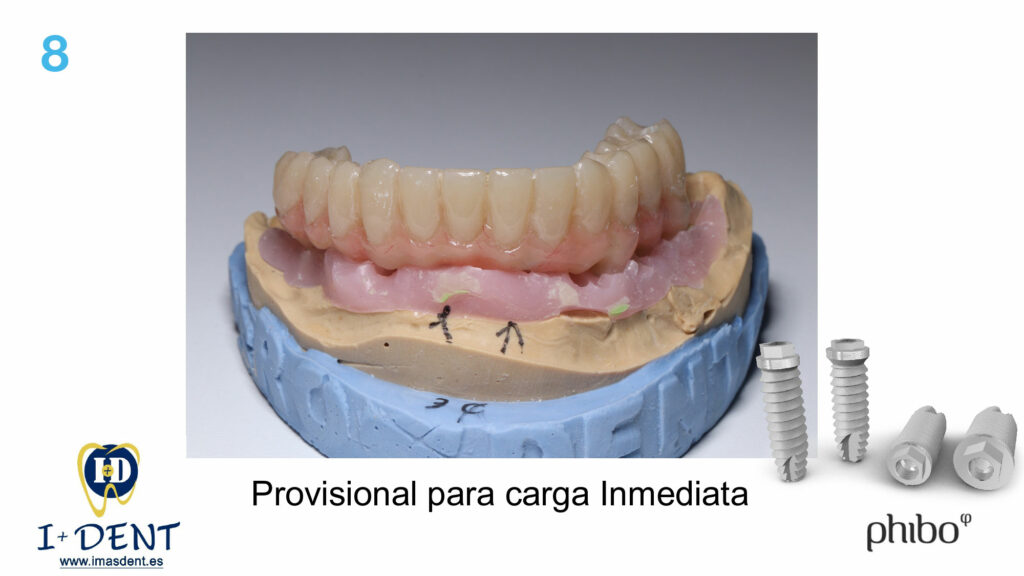 CARGA-INMEDIATA-Inferior-TSH-Oscar-Arias_0008
