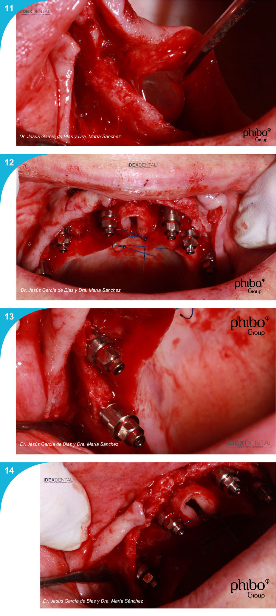 dr_deblas_adoracion_004