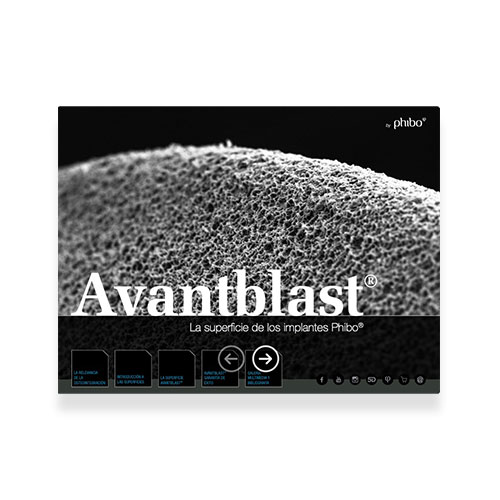 Avantblast