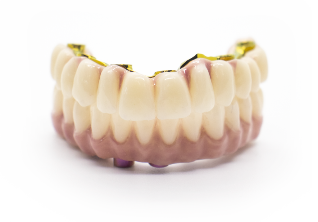 ipso_protesis_completa