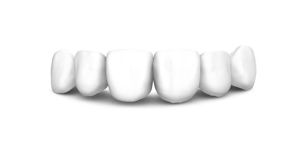 phidia-cementada-2-2