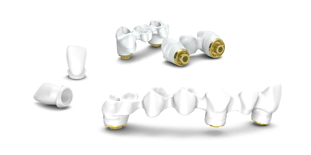 protesis-atorornillada-zirconia-2