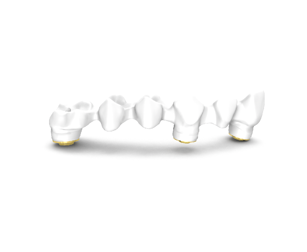 zirconia-phidia-atronillada-multiples